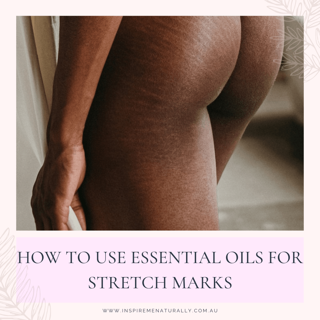 How to Use Essential Oils for Stretch Marks - Inspire Me Naturally 